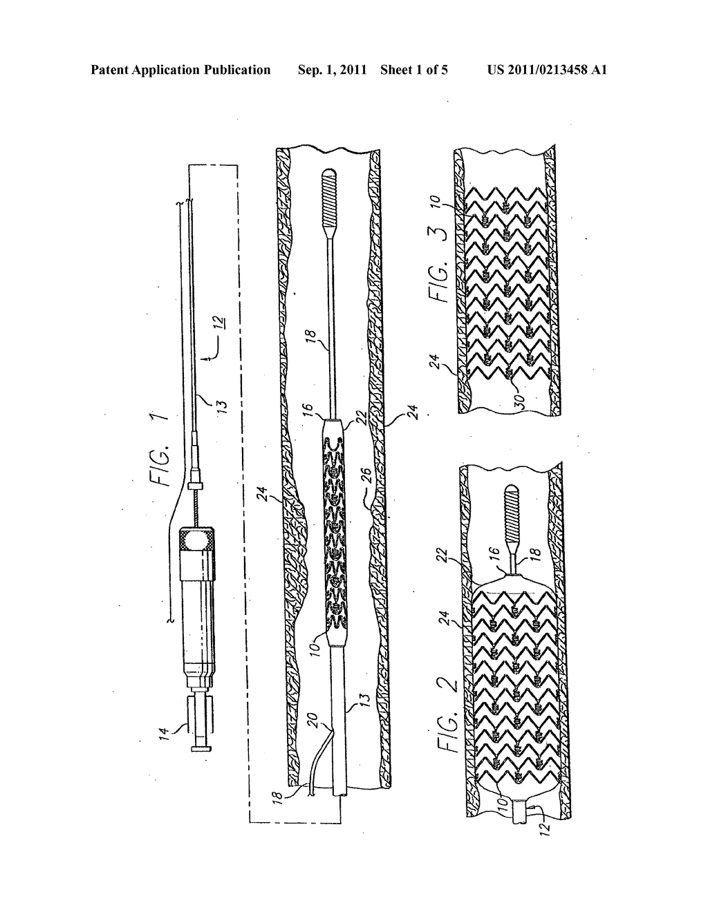 INTRAVASCULAR STENT - diagram, schematic, and image 02