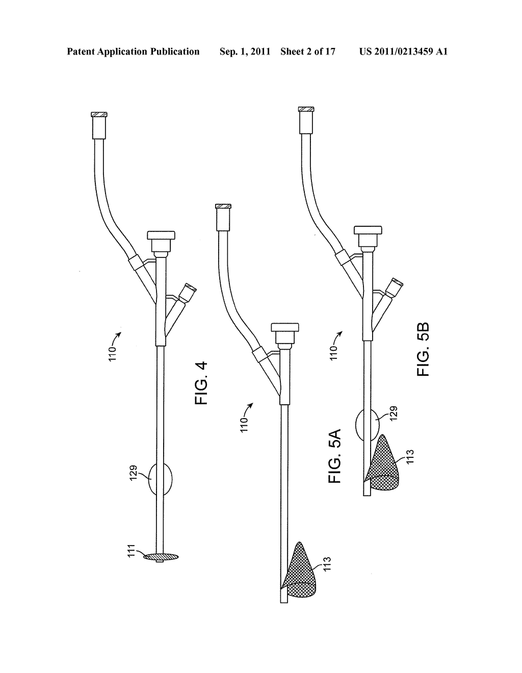 SYSTEMS AND METHODS FOR TRANSCATHETER AORTIC VALVE TREATMENT - diagram, schematic, and image 03