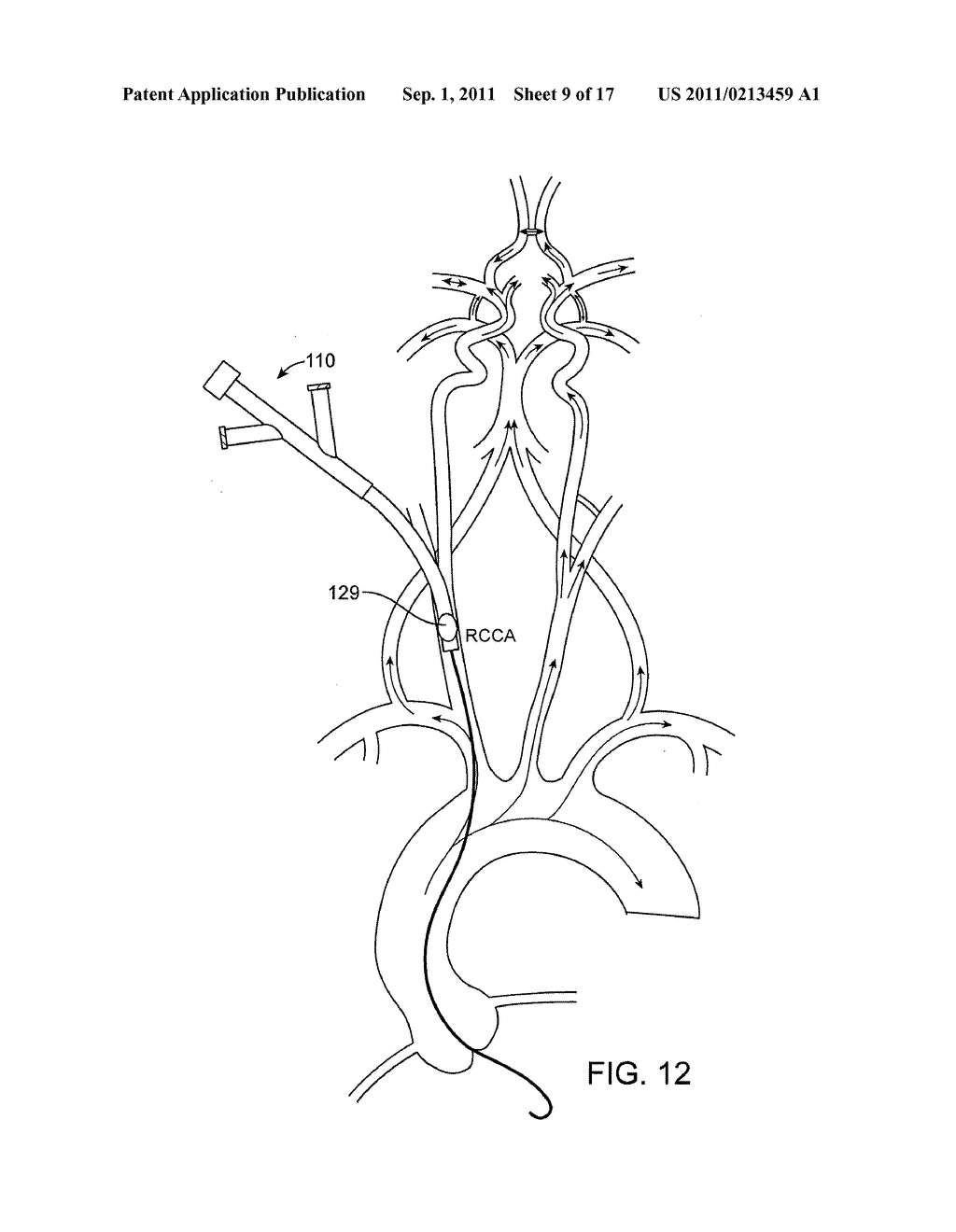 SYSTEMS AND METHODS FOR TRANSCATHETER AORTIC VALVE TREATMENT - diagram, schematic, and image 10