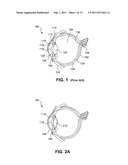 Multi-Focal Intraocular Lens System and Methods diagram and image