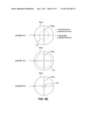 Multi-Focal Intraocular Lens System and Methods diagram and image