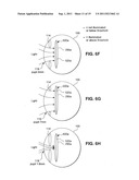 Multi-Focal Intraocular Lens System and Methods diagram and image