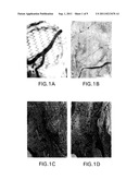 METHODS FOR USING A THREE-DIMENSIONAL STROMAL TISSUE TO PROMOTE     ANGIOGENESIS diagram and image