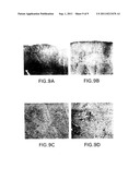 METHODS FOR USING A THREE-DIMENSIONAL STROMAL TISSUE TO PROMOTE     ANGIOGENESIS diagram and image