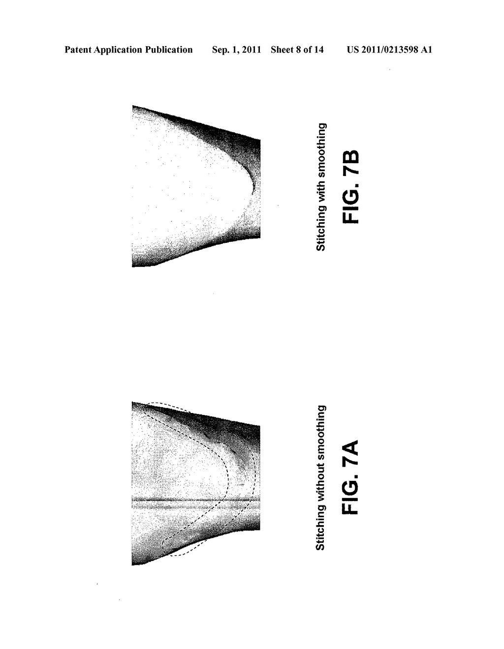 SYSTEM AND METHOD FOR THREE-DIMENSIONAL COMPLETE TOOTH MODELING - diagram, schematic, and image 09