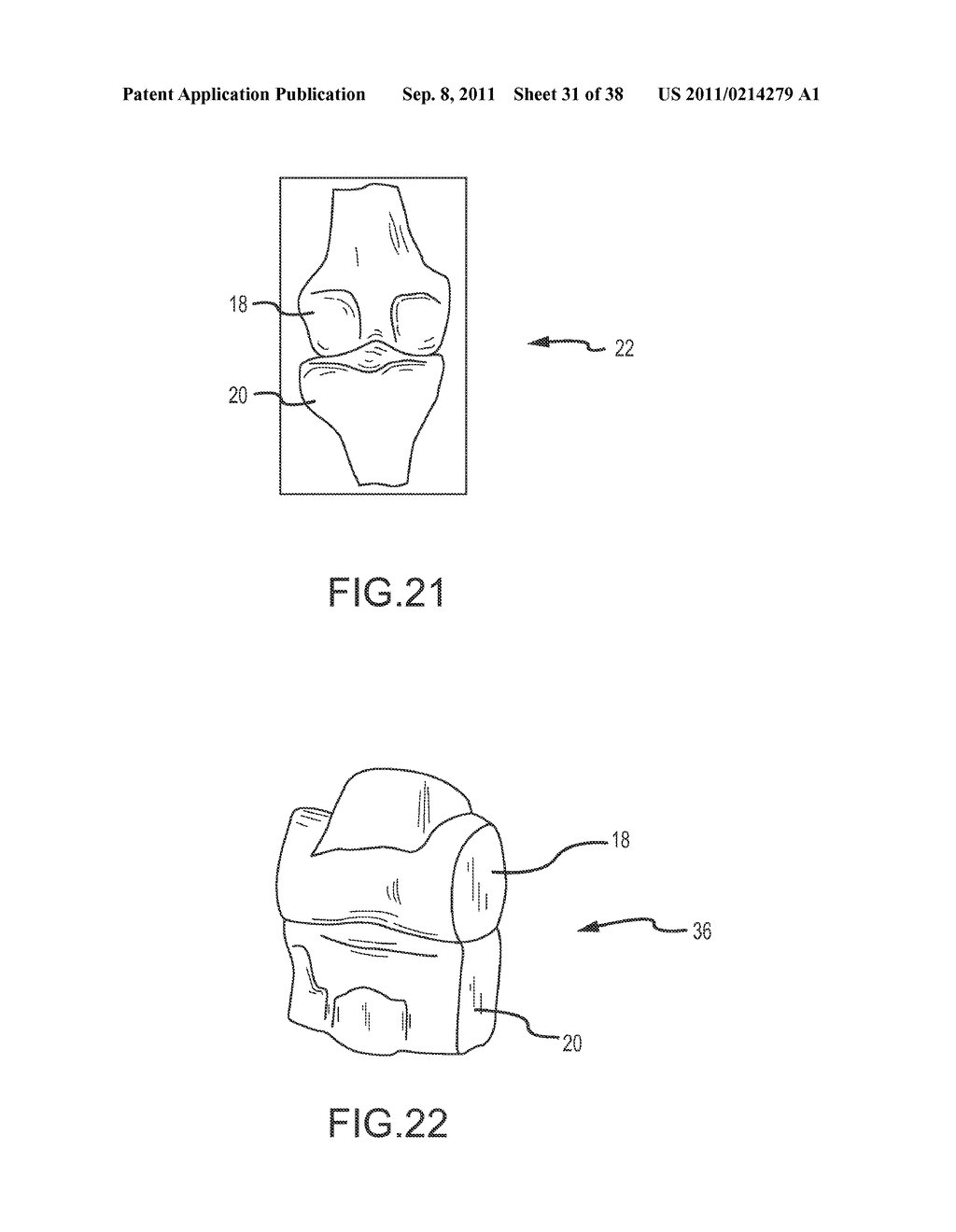 PREOPERATIVELY PLANNING AN ARTHROPLASTY PROCEDURE AND GENERATING A     CORRESPONDING PATIENT SPECIFIC ARTHROPLASTY RESECTION GUIDE - diagram, schematic, and image 32