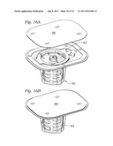 Dry Prosthetic Heart Valve Packaging System diagram and image