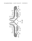 METHODS, SYSTEMS AND DEVICES FOR NON-INVASIVE VENTILATION INCLUDING A     NON-SEALING VENTILATION INTERFACE WITH AN ENTRAINMENT PORT AND/OR     PRESSURE FEATURE diagram and image