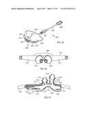 METHODS, SYSTEMS AND DEVICES FOR NON-INVASIVE VENTILATION INCLUDING A     NON-SEALING VENTILATION INTERFACE WITH AN ENTRAINMENT PORT AND/OR     PRESSURE FEATURE diagram and image