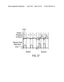 METHODS, SYSTEMS AND DEVICES FOR NON-INVASIVE VENTILATION INCLUDING A     NON-SEALING VENTILATION INTERFACE WITH AN ENTRAINMENT PORT AND/OR     PRESSURE FEATURE diagram and image