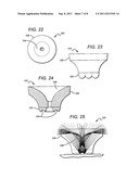 SOLID STATE LAMP WITH THERMAL SPREADING ELEMENTS AND LIGHT DIRECTING     OPTICS diagram and image