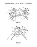 TIGHTENING DEVICE WITH COLLAR diagram and image