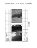 METHOD AND SYSTEM FOR INTERPRETING MEDICAL IMAGE DATA diagram and image