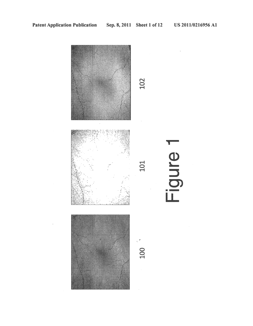 Methods, Systems and Computer Program Products for Collapsing Volume Data     to Lower Dimensional Representations Thereof - diagram, schematic, and image 02