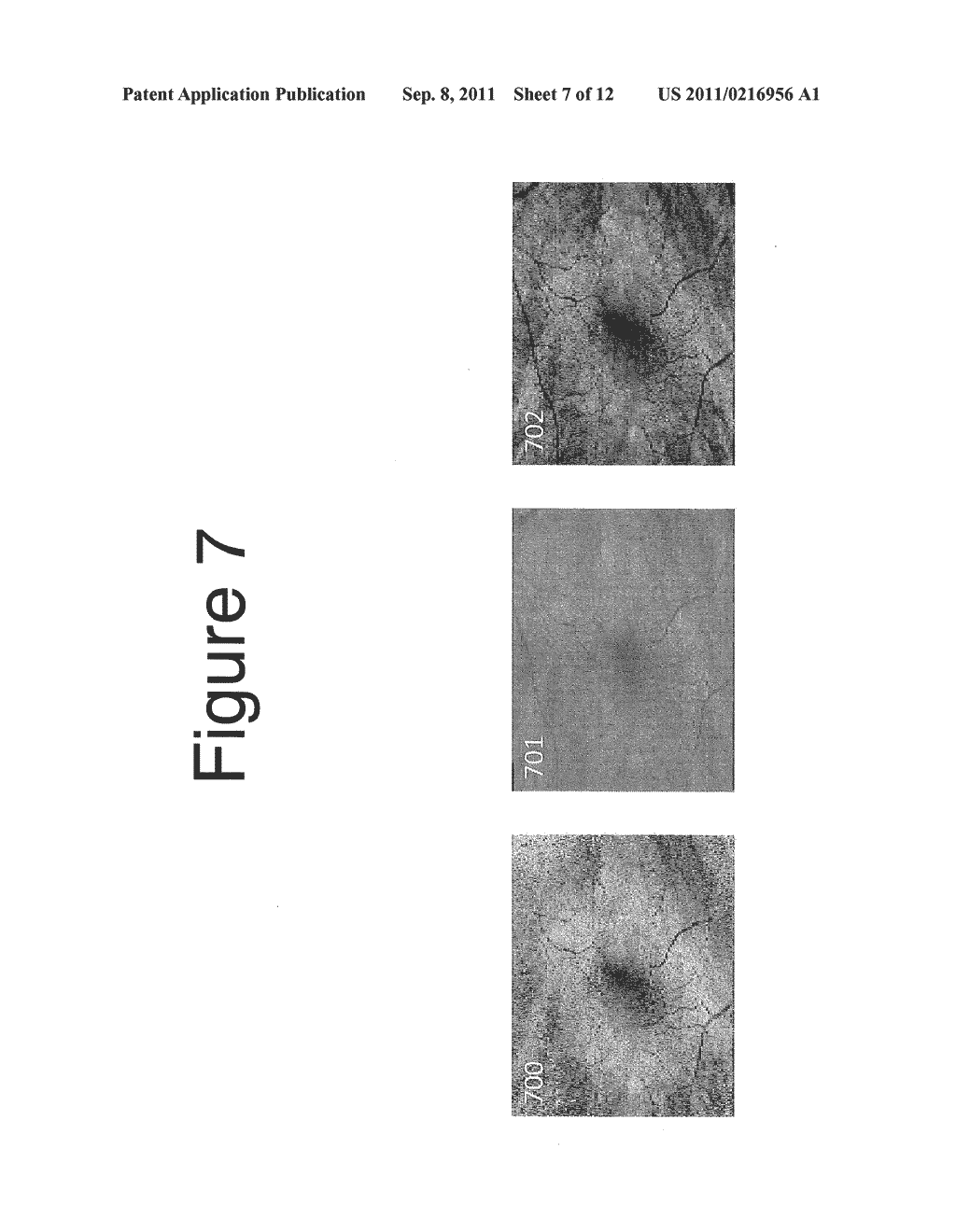 Methods, Systems and Computer Program Products for Collapsing Volume Data     to Lower Dimensional Representations Thereof - diagram, schematic, and image 08