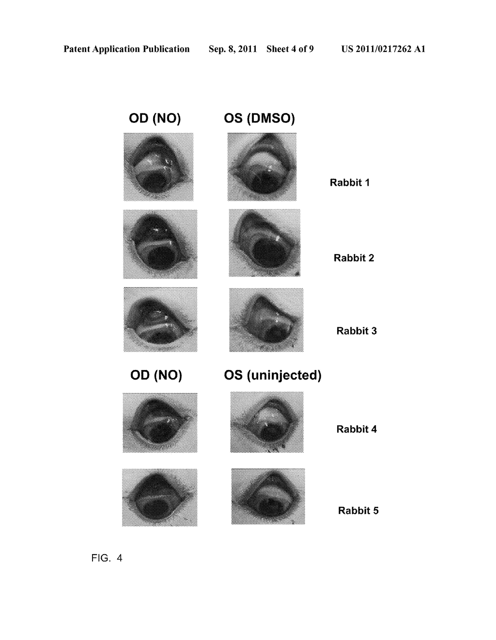 Treatment of Ocular Surface Disorders by Increasing Conjunctival Vascular     Permeability - diagram, schematic, and image 05