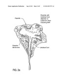 TREATMENT OF DISEASES OR DISORDERS USING PLACENTAL STEM CELLS diagram and image