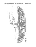 TREATMENT OF DISEASES OR DISORDERS USING PLACENTAL STEM CELLS diagram and image