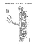 TREATMENT OF DISEASES OR DISORDERS USING PLACENTAL STEM CELLS diagram and image