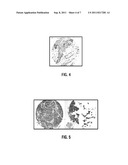 METHODS FOR DIAGNOSIS AND PROGNOSIS OF CANCER diagram and image