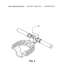 MANDIBULAR MANIPULATOR diagram and image