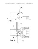 MANDIBULAR MANIPULATOR diagram and image