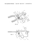 MANDIBULAR MANIPULATOR diagram and image