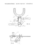 MANDIBULAR MANIPULATOR diagram and image