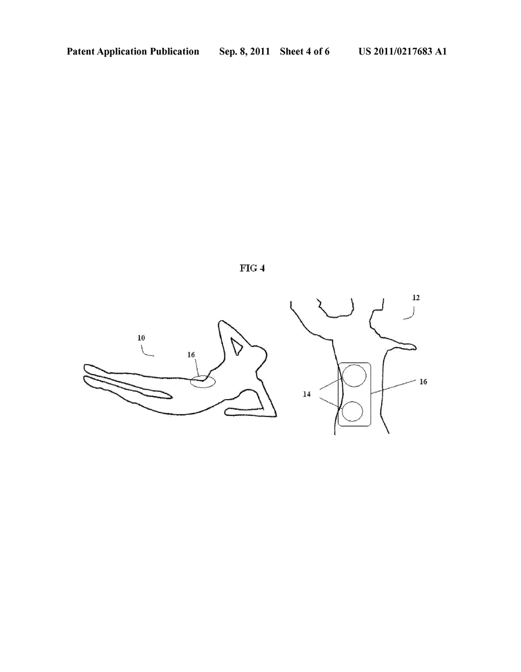 METHODS AND SYSTEMS FOR USING A VISUAL SIGNAL AS A CONCENTRATION AID - diagram, schematic, and image 05