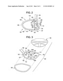 GOLF CLUB HEAD OR OTHER BALL STRIKING DEVICE HAVING ADJUSTABLE STIFFENED     FACE PORTION diagram and image