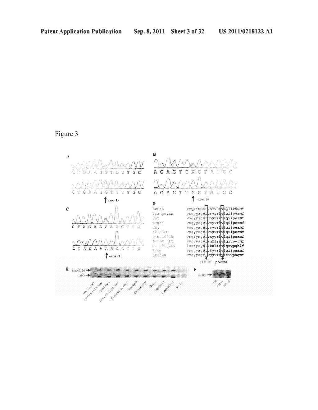 METHOD OF PROGNOSING AND DIAGNOSING HEREDITARY SPASTIC PARAPLEGIA, MUTANT     NUCLEIC ACID MOLECULES AND POLYPEPTIDES - diagram, schematic, and image 04