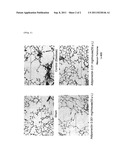 ADIPONECTIN FOR TREATING PULMONARY DISEASE diagram and image