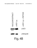 HISTONE DEACETYLASES, AND USES RELATED THERETO diagram and image