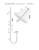 BRAIN PROBE ADAPTED TO BE INTRODUCED THROUGH A CANULA diagram and image