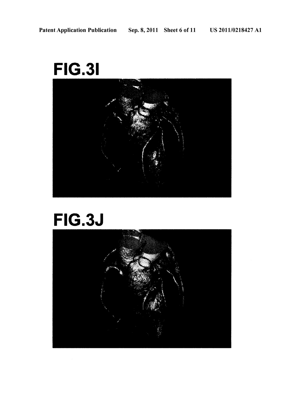 DIAGNOSIS ASSISTING APPARATUS, CORONARY ARTERY ANALYZING METHOD AND     RECORDING MEDIUM HAVING A CORONARY ARTERY ANALYZING PROGRAM STORED     THEREIN - diagram, schematic, and image 07