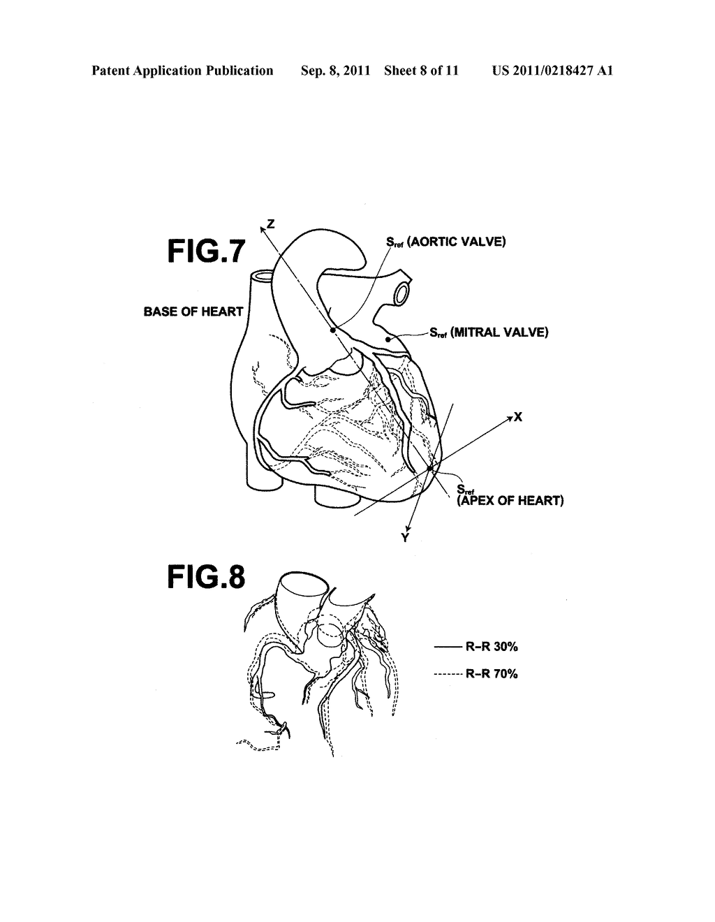 DIAGNOSIS ASSISTING APPARATUS, CORONARY ARTERY ANALYZING METHOD AND     RECORDING MEDIUM HAVING A CORONARY ARTERY ANALYZING PROGRAM STORED     THEREIN - diagram, schematic, and image 09