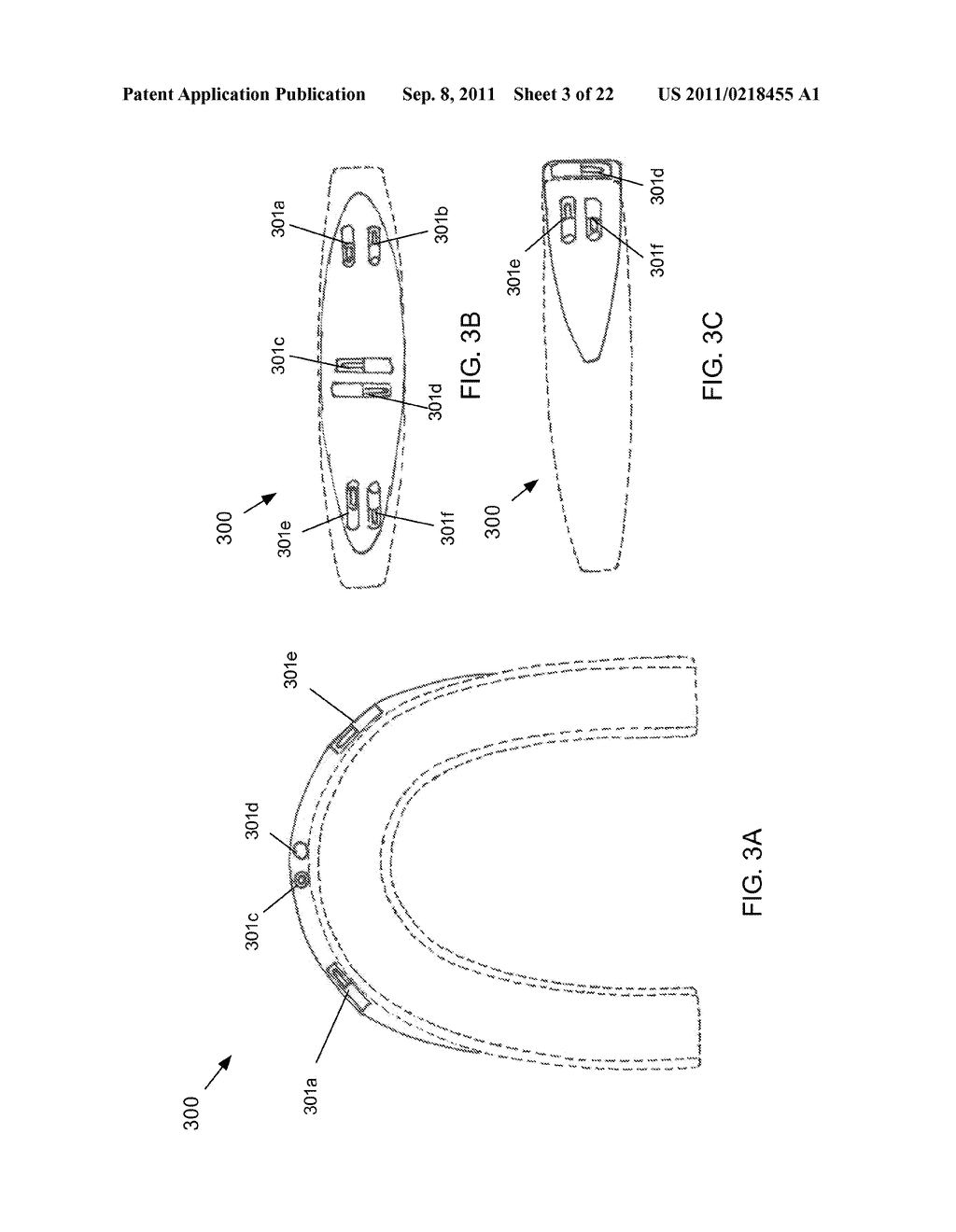 INTRA-EXTRA ORAL SHOCK-SENSING AND INDICATING SYSTEMS AND OTHER     SHOCK-SENSING AND INDICATING SYSTEMS - diagram, schematic, and image 04