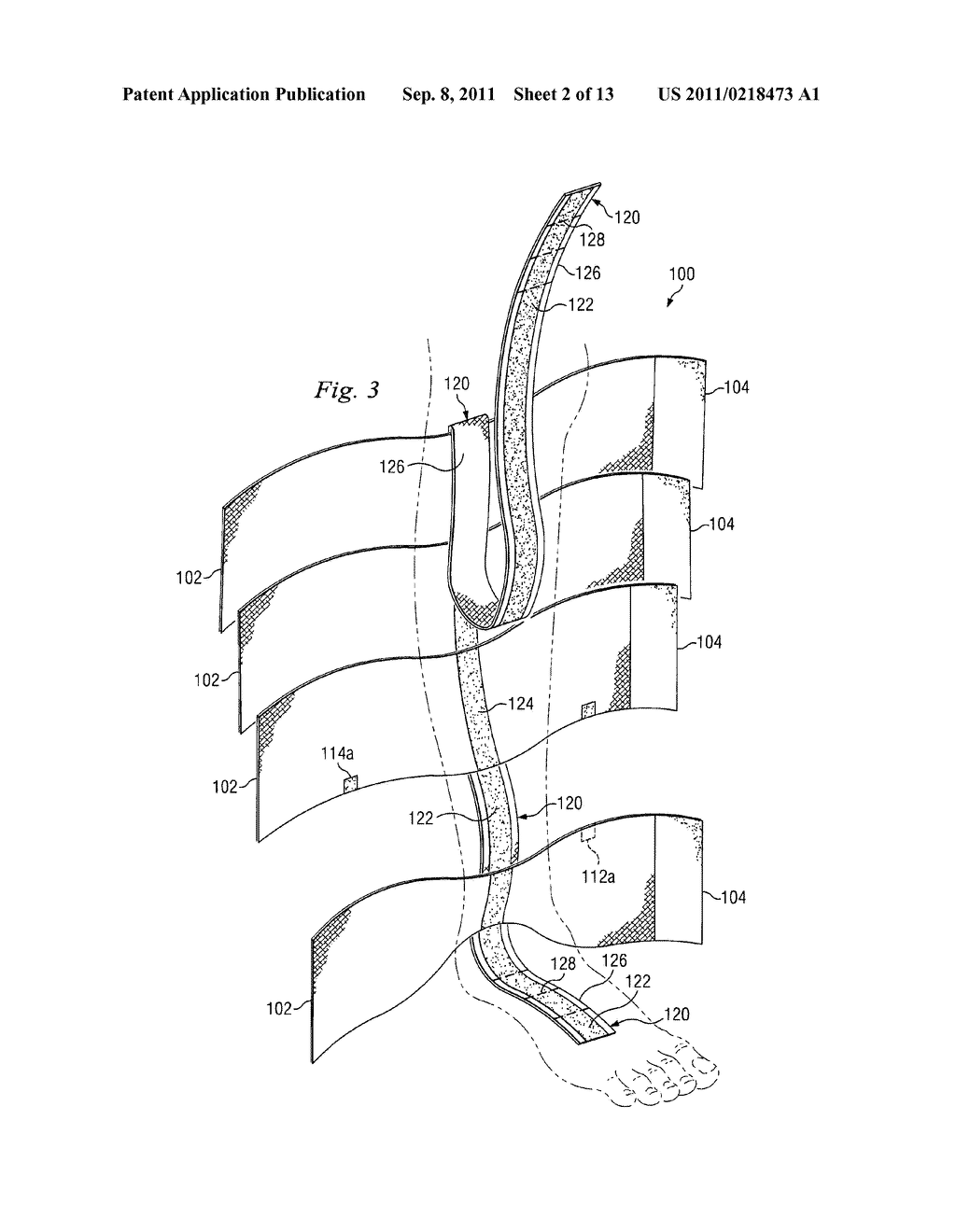 HYBRID COMPRESSION STOCKING - diagram, schematic, and image 03