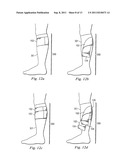 HYBRID COMPRESSION STOCKING diagram and image