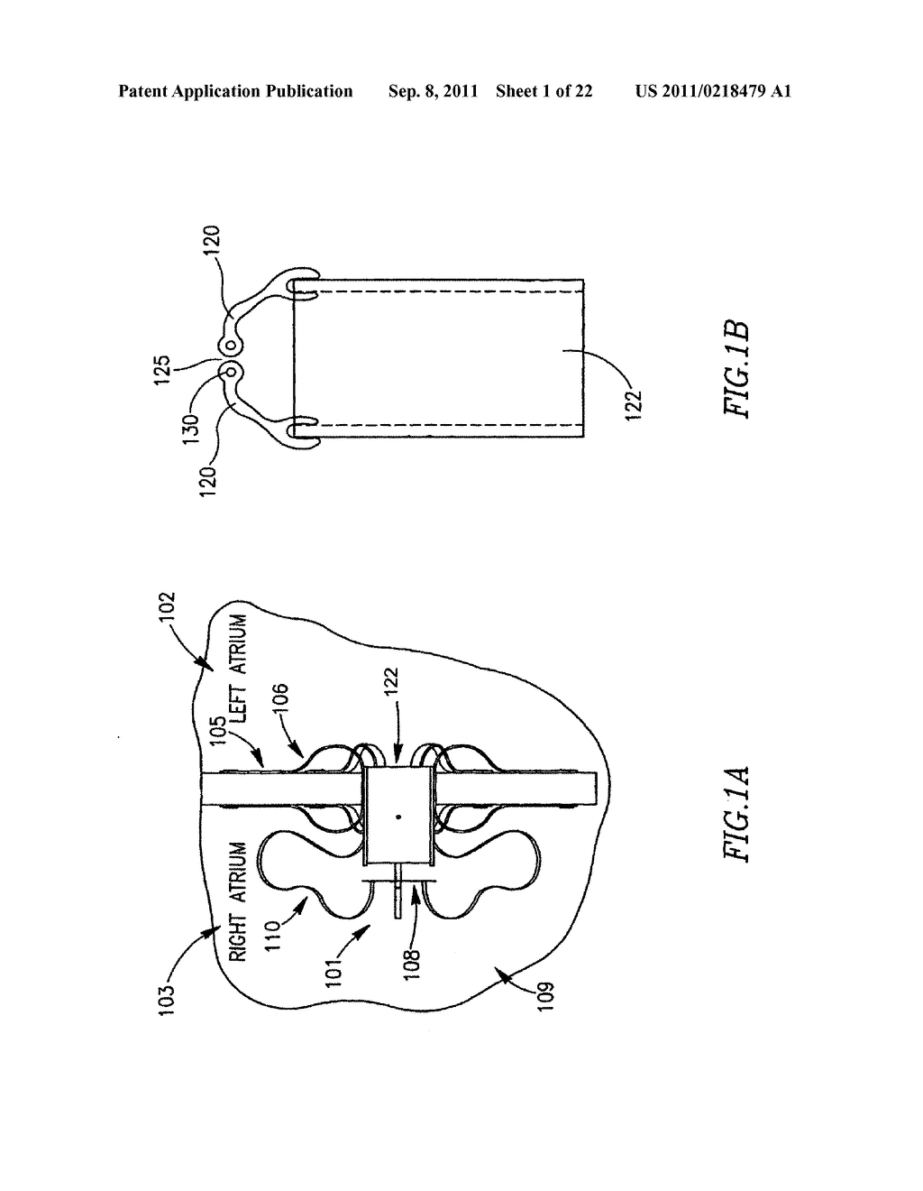 DEVICE AND METHOD FOR CONTROLLING IN-VIVO PRESSURE - diagram, schematic, and image 02