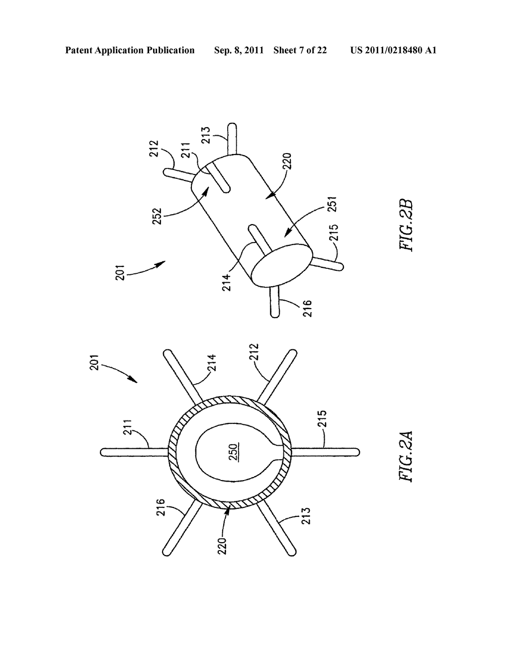 DEVICE AND METHOD FOR CONTROLLING IN-VIVO PRESSURE - diagram, schematic, and image 08