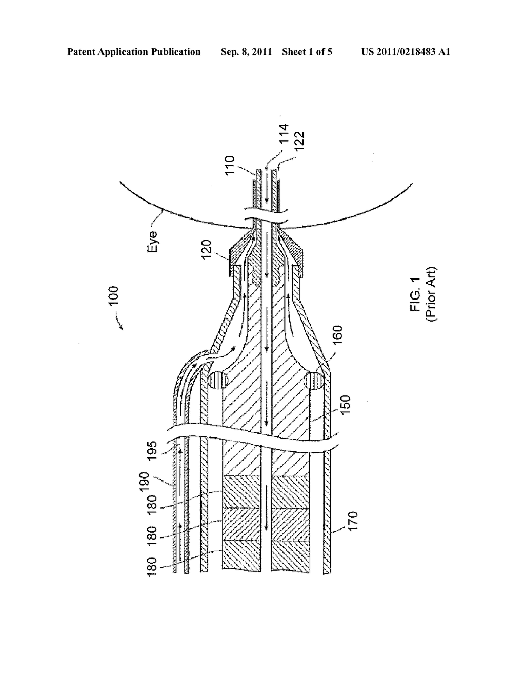 METHOD FOR USING MICROELECTROMECHANICAL SYSTEMS TO GENERATE MOVEMENT IN A     PHACOEMULSIFICATION HANDPIECE - diagram, schematic, and image 02