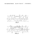 Multi-Balloon Catheter for Extravasated Drug Delivery diagram and image