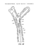 Multi-Balloon Catheter for Extravasated Drug Delivery diagram and image