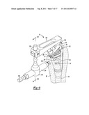 Method and Apparatus for Preparing a Proximal Femur diagram and image