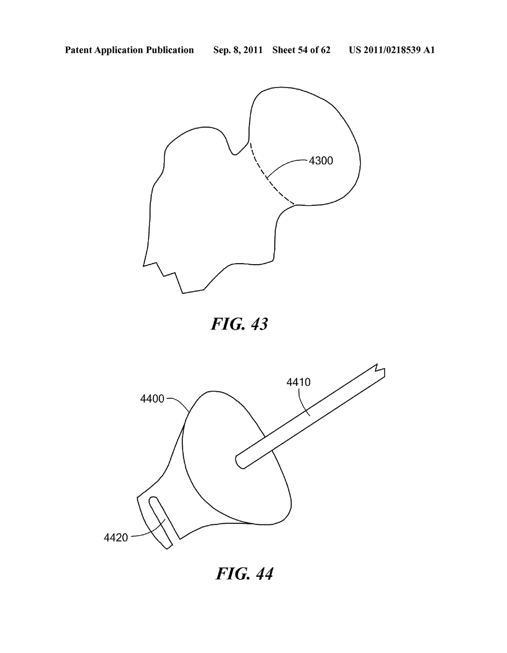 Patient Selectable Joint Arthroplasty Devices and Surgical Tools - diagram, schematic, and image 55