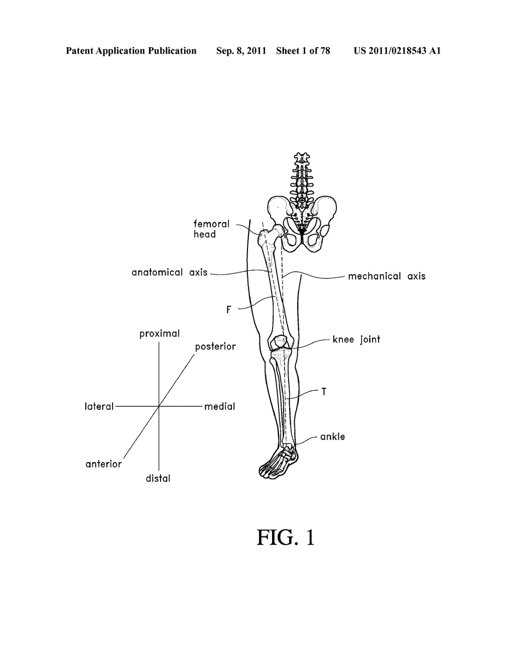 SYSTEMS AND METHODS FOR JOINT REPLACEMENT - diagram, schematic, and image 02