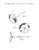 METHOD FOR LEFT ATRIAL APPENDAGE OCCLUSION diagram and image