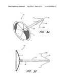 METHOD FOR LEFT ATRIAL APPENDAGE OCCLUSION diagram and image