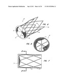 METHOD FOR LEFT ATRIAL APPENDAGE OCCLUSION diagram and image